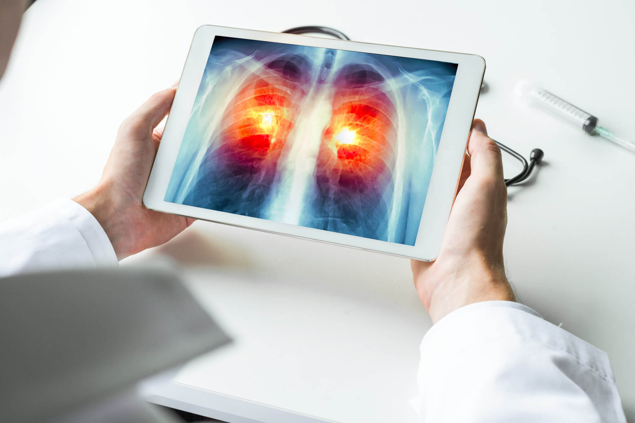 Choroby płuc - kiedy kaszel może być powodem do niepokoju?